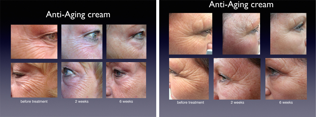 creme-levelle-exemple-visage-2